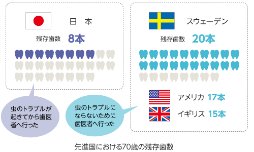 先進国における70歳の残存歯数（スウェーデン20本、アメリカ17本、イギリス15本に対して、日本は8本）